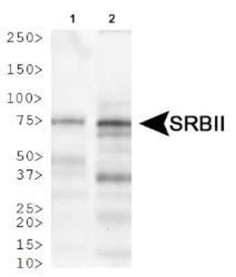 Western Blot: LIMPII/SR-B2 Antibody [NB400-102]