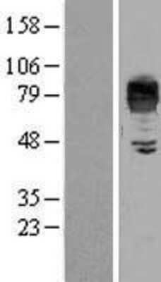 Western Blot: LIMPII/SR-B2 Overexpression Lysate [NBP2-04294]