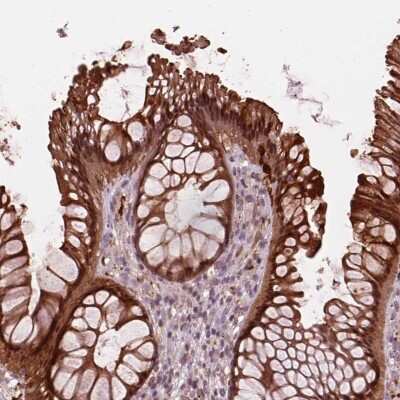 Immunohistochemistry-Paraffin: SRI Antibody [NBP2-57990]