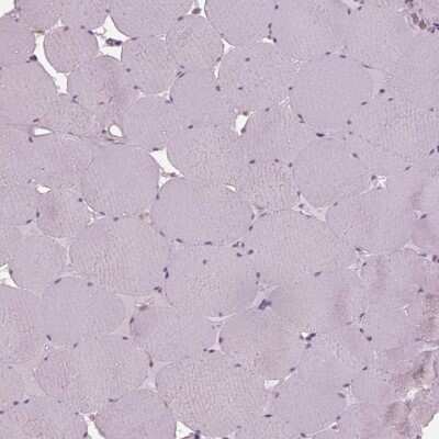 Immunohistochemistry-Paraffin: SRI Antibody [NBP2-57990]