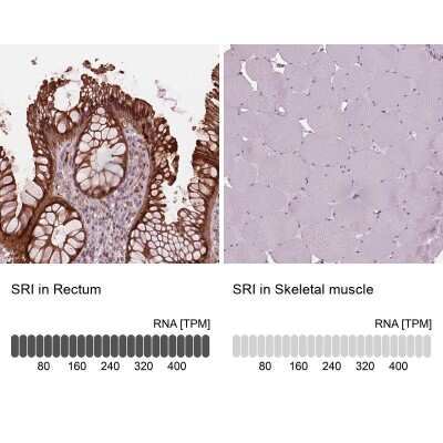 Immunohistochemistry-Paraffin: SRI Antibody [NBP2-57990]