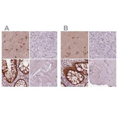 Immunohistochemistry-Paraffin: SRI Antibody [NBP2-57990]