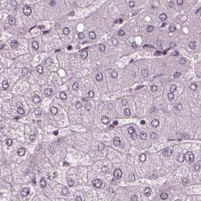 Immunohistochemistry-Paraffin: SRI Antibody [NBP2-57990]