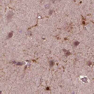 Immunohistochemistry-Paraffin: SRI Antibody [NBP2-57990]