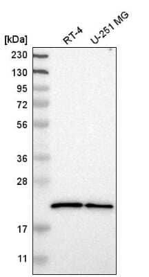 Western Blot: SRI Antibody [NBP2-55404]