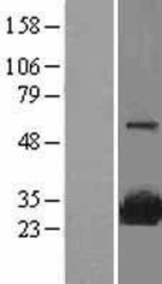 Western Blot: SRI Overexpression Lysate [NBL1-16450]