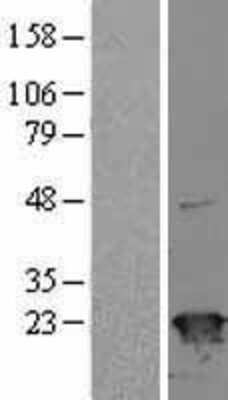 Western Blot: SRI Overexpression Lysate [NBL1-16451]