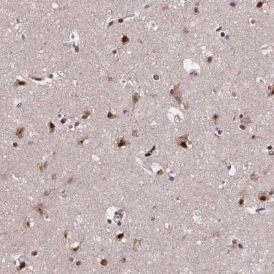 Immunohistochemistry-Paraffin: SR140 Antibody [NBP2-55742]
