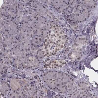 Immunohistochemistry-Paraffin: SR140 Antibody [NBP2-55742]