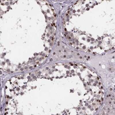 Immunohistochemistry-Paraffin: SR140 Antibody [NBP2-55742]