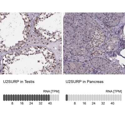 Immunohistochemistry-Paraffin: SR140 Antibody [NBP2-55742]