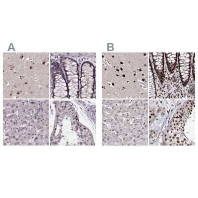 Immunohistochemistry-Paraffin: SR140 Antibody [NBP2-55742]