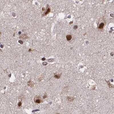 Immunohistochemistry-Paraffin: SR140 Antibody [NBP2-55742]