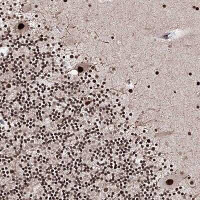 Immunohistochemistry-Paraffin: SR140 Antibody [NBP2-58175]