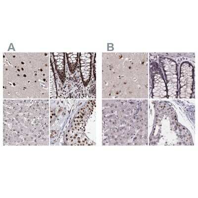 Immunohistochemistry-Paraffin: SR140 Antibody [NBP2-58175]