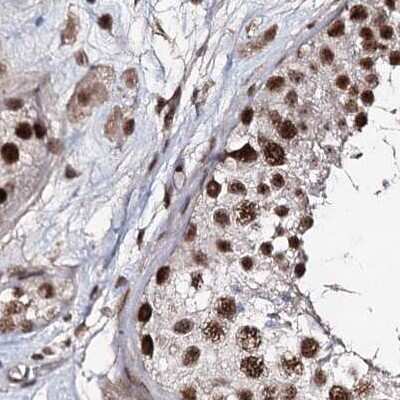 Immunohistochemistry-Paraffin: SR140 Antibody [NBP2-58175]