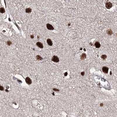 Immunohistochemistry-Paraffin: SR140 Antibody [NBP2-58175]