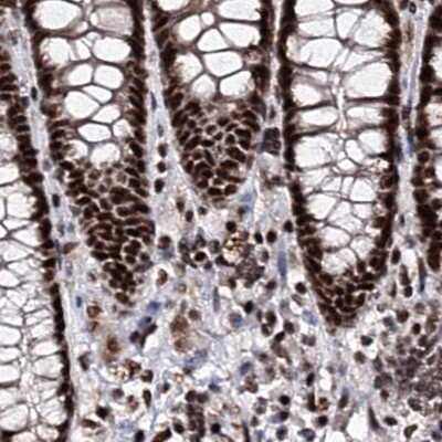 Immunohistochemistry-Paraffin: SR140 Antibody [NBP2-58175]