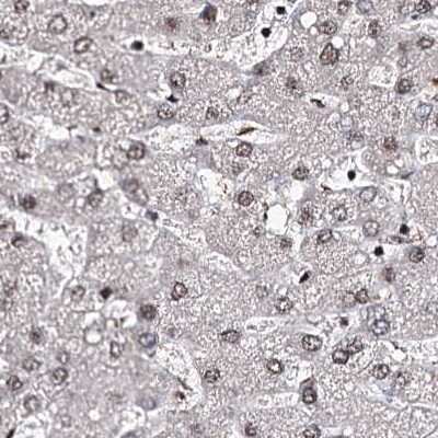 Immunohistochemistry-Paraffin: SR140 Antibody [NBP2-58175]