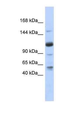 Western Blot: SR140 Antibody [NBP1-70713]