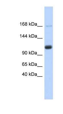 Western Blot: SR140 Antibody [NBP1-70714]