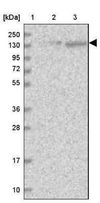 Western Blot: SR140 Antibody [NBP1-92444]