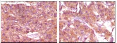 Immunohistochemistry-Paraffin: SRA1 Antibody (1D4H8) - BSA Free [NBP1-51531]