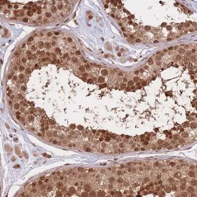 Immunohistochemistry-Paraffin: SRA1 Antibody [NBP2-47260]