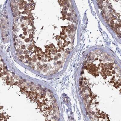 Immunohistochemistry-Paraffin: SRA1 Antibody [NBP2-48816]