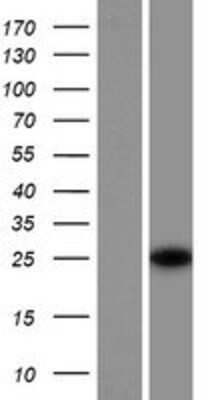 Western Blot: SRA1 Overexpression Lysate [NBP2-08584]