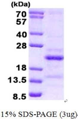 SDS-PAGE: Recombinant Human SRA1 His Protein [NBP2-22832]