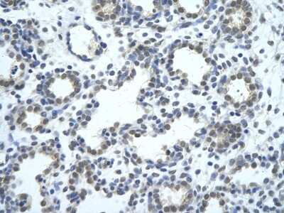 Immunohistochemistry: SRBD1 Antibody [NBP1-57557]