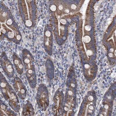Immunohistochemistry-Paraffin: SRBD1 Antibody [NBP1-84630]