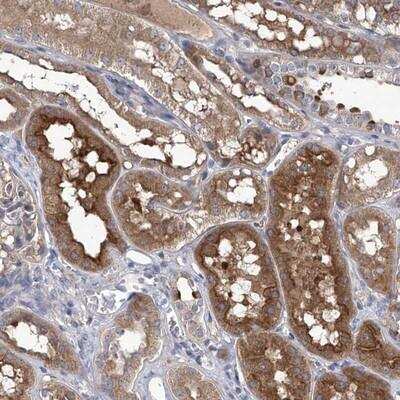 Immunohistochemistry-Paraffin: SRBD1 Antibody [NBP1-84631]