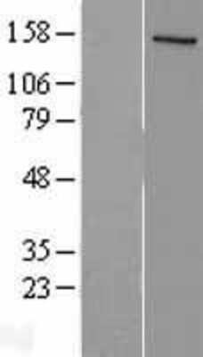 Western Blot: SRC1 Overexpression Lysate [NBL1-13515]