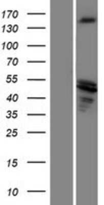 Western Blot: SRC1 Overexpression Lysate [NBP2-05443]