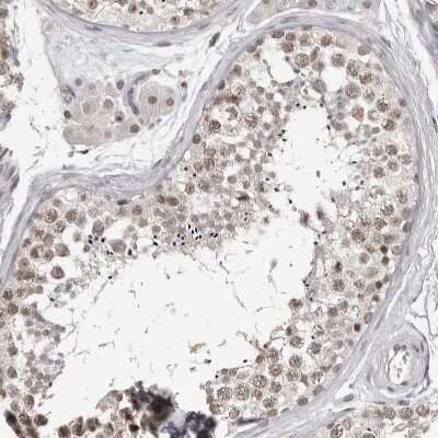 Immunohistochemistry-Paraffin: SRCAP Antibody [NBP1-84063]