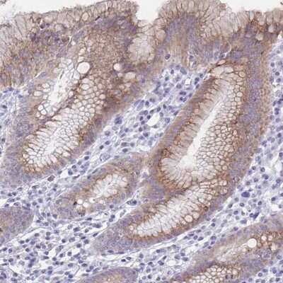 Immunohistochemistry-Paraffin: SRCRB4D Antibody [NBP2-37994]