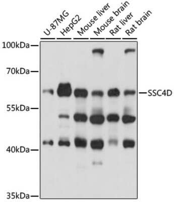 Western Blot: SRCRB4D AntibodyAzide and BSA Free [NBP2-94446]