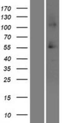 Western Blot: SRCRB4D Overexpression Lysate [NBP2-05760]