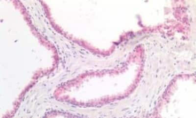 Immunohistochemistry-Paraffin: SRD5A1 Antibody [NBP3-14482]