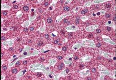 Immunohistochemistry-Paraffin: SRD5A1 Antibody [NB100-1491]