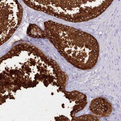 Immunohistochemistry-Paraffin: SRD5A1 Antibody [NBP2-31909]