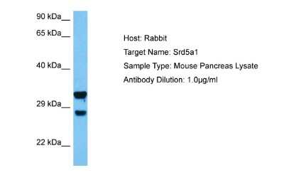Western Blot: SRD5A1 Antibody [NBP2-88362]