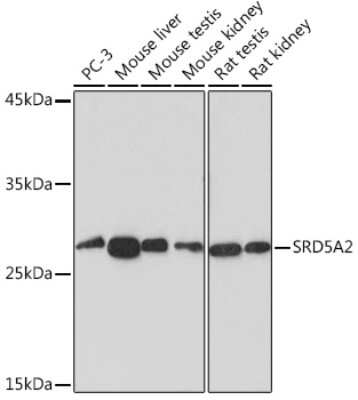 Western Blot: SRD5A2 Antibody (8A4H5) [NBP3-15900]