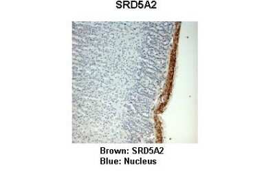 Immunohistochemistry: SRD5A2 Antibody [NBP1-69492]