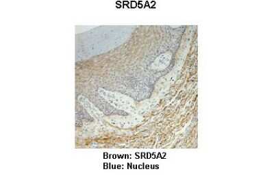Immunohistochemistry: SRD5A2 Antibody [NBP1-69492]