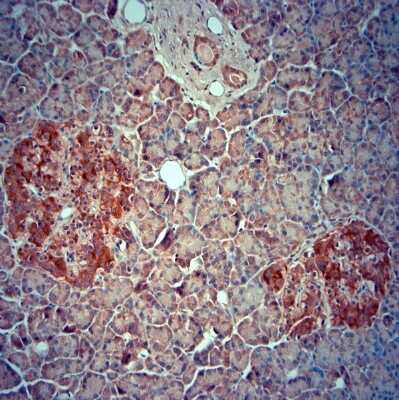 Immunohistochemistry-Paraffin: SRD5A2 Antibody [NBP1-46510]