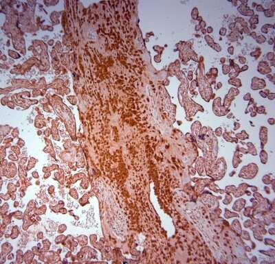 Immunohistochemistry-Paraffin: SRD5A2 Antibody [NBP1-46510]