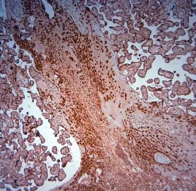 Immunohistochemistry-Paraffin: SRD5A2 Antibody [NBP1-46510]
